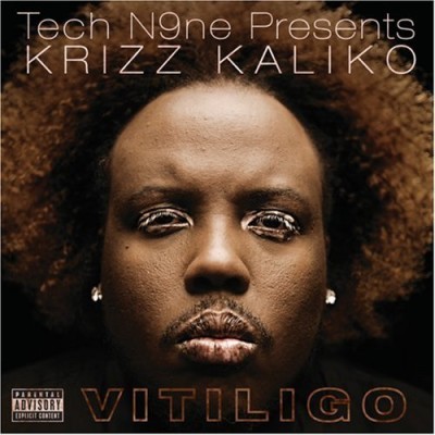 Krizz Kaliko 2008 Vitiligo